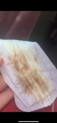 Is this a miscarriage?