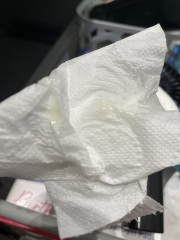 Mucus plug or just discharge?