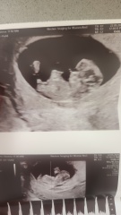 Just for fun - early nub guesses