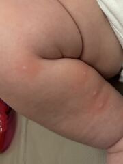 Really anxious. What is this? 13 week old. Spots on body
