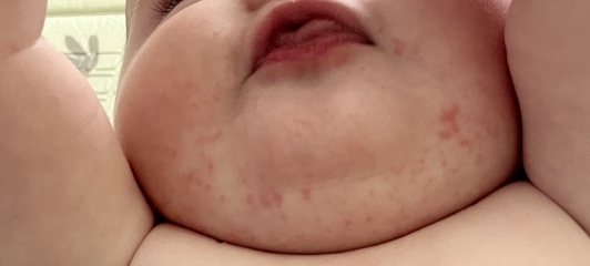 Egg reaction? Help please