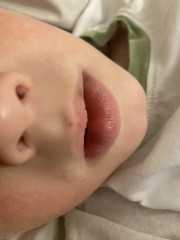 What is this on my child’s face?