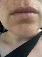 What is this on my mouth and head ?