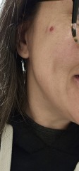 Is this just a spot or something to worry about?