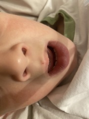 What is this on my child’s face?