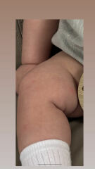 Really anxious. What is this? 13 week old. Spots on body