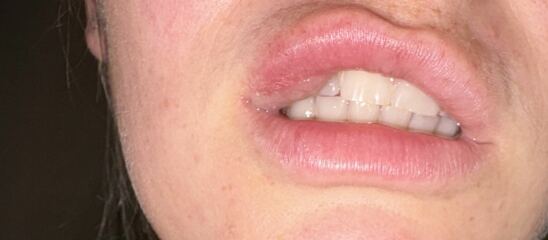 To wonder what kind of monster ulcer IS this…?! TW!