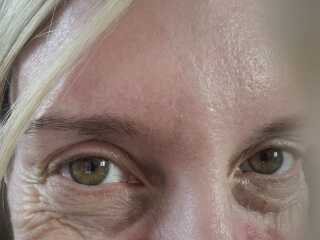 Eye help please