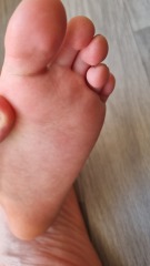Podiatry advice needed!
