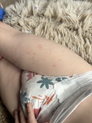 Undiagnosed skin condition