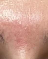 Skincare recommendations (pics!)