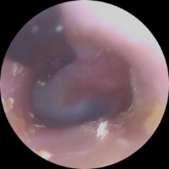 I appear to have misplaced my left eardrum. There's pictures. So. You know, you were warned. If you click, it's on you.