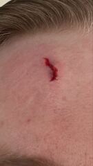 Does this need A&E ?