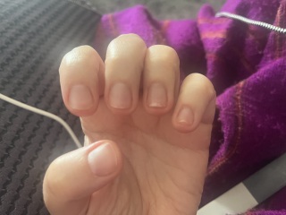 What is happening to nails and how to fix?