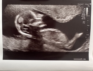 Gender guesses nub theory?