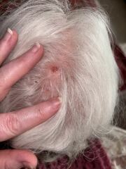 Could this be skin cancer?