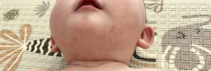 Egg reaction? Help please