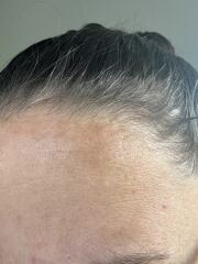 What is this on my mouth and head ?