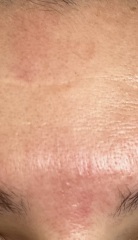 Skincare recommendations (pics!)
