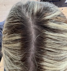 Highlights, a question? The dreaded root line.