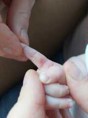 Is this cut infected? Any advice?