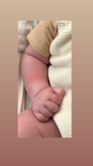 Really anxious. What is this? 13 week old. Spots on body