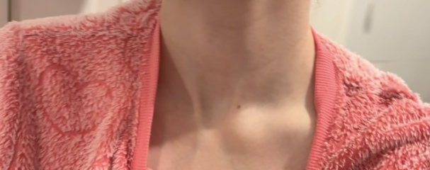 Lump question