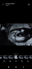 Gender Potty shot doubts? 16+1 weeks