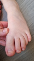 Podiatry advice needed!