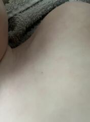 Random non-blanching dots on toddler