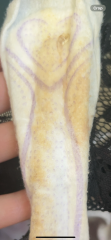 Is this a miscarriage?