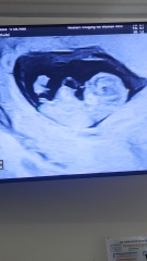 “Confirmed” nub theories