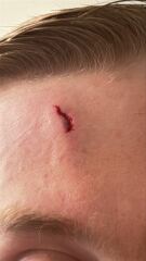 Does this need A&E ?