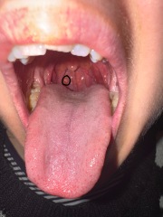 What is this white lump?