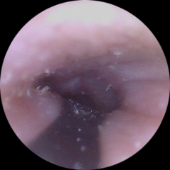I appear to have misplaced my left eardrum. There's pictures. So. You know, you were warned. If you click, it's on you.