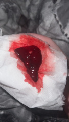 Is this a miscarriage please help!