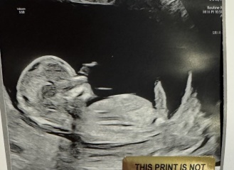 14 week ultrasound gender guess?