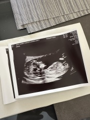 Boy or Girl? 🩵🩷