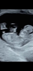Just for fun - early nub guesses