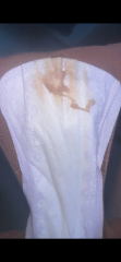 Is this a miscarriage?