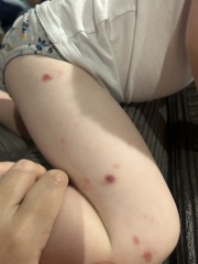 Weird spots 4 year old