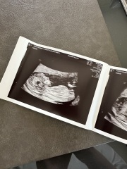 Boy or Girl? 🩵🩷
