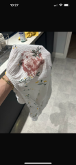 Has anyone else’s baby been injured by the Snuggle Baby Bath?
