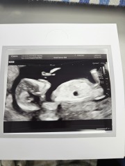 What do we think? Boy or girl?