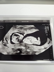 What do we think? Boy or girl?