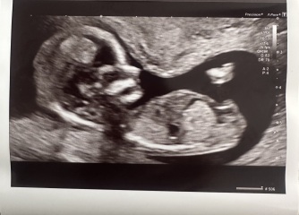 Gender guesses nub theory?