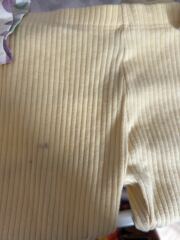 What are these stains?