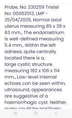 Worried, scared, anxious, terrified... Large ovarian cyst