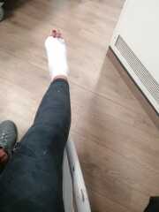 To ask what’s the most ridiculous injury you’ve given yourself?