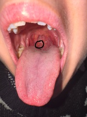 What is this white lump?